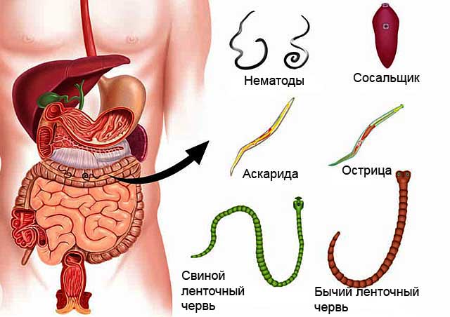 Разновидности паразитарных червей 